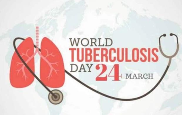 World Tuberculosis Day 2022, World TB Day, World Health Organization, TB symptoms, TB treatment, Home remedies to treat TB, Trending News- True Scoop