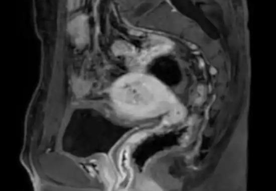 Chinese Man Ovaries and Uterus, Ovaries and Uterus Chinese Man, China Man Female Organism, Chen China Ovaries and Uterus, China, Man Had Ovaries And Uterus, China Man Menstruating For 20 years,Man Had Female Parts China- True Scoop