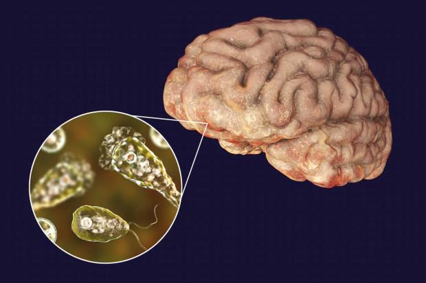 World News, World News Today,Top World News, World News Headlines,World Breaking News,International News,Latest World News, Politics News, Deaths Related to Brain Eating Amoeba, What is Brain Eating Amoeba, Brain Eating Amoeba in USA,- True Scoop