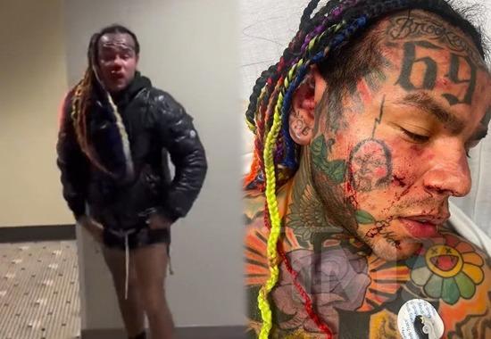 Tekashi 6ix9ine, Tekashi 6ix9ine Fight, Tekashi 6ix9ine Fight Reason, Why Tekashi 6ix9ine Was attacked, Tekashi 6ix9ine Attack Reason, Tekashi 6ix9ine Federal Informant, Hollywood News Today, Latest Hollywood News, Top Hollywood News, Hollywood Updates,Entertainment News, Entertainment News Today, Latest Entertainment News, Top Bollywood News, Top Celebrity News,Hollywood News Today, Latest Hollywood News, Top Hollywood News, Hollywood Updates- True Scoop